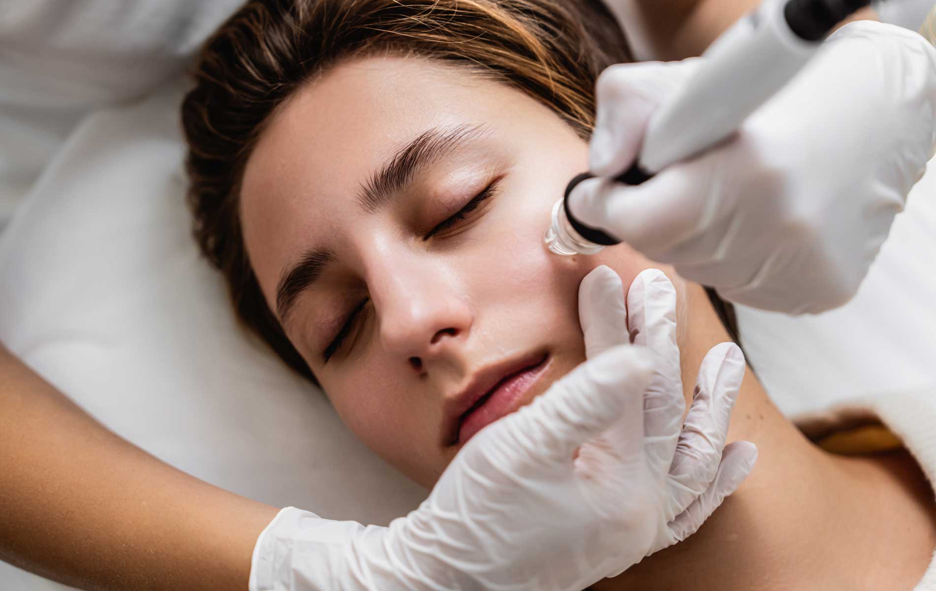 Facial with Microdermabrasion